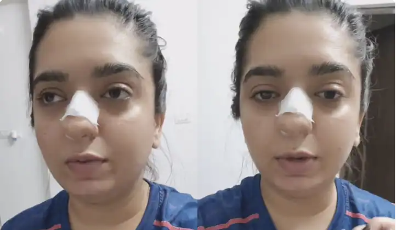 Frontlist | Bengaluru Woman Alleges Zomato Delivery Man Hit Her, Shows Bloody Nose